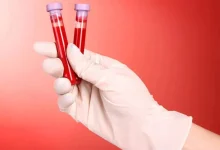 Olovo u krvi potvrđeno kod svih 85 testiranih građana Vareša