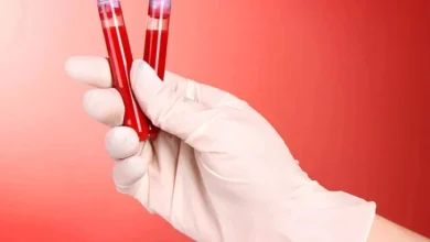 Olovo u krvi potvrđeno kod svih 85 testiranih građana Vareša