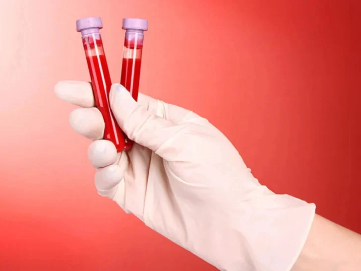 Olovo u krvi potvrđeno kod svih 85 testiranih građana Vareša